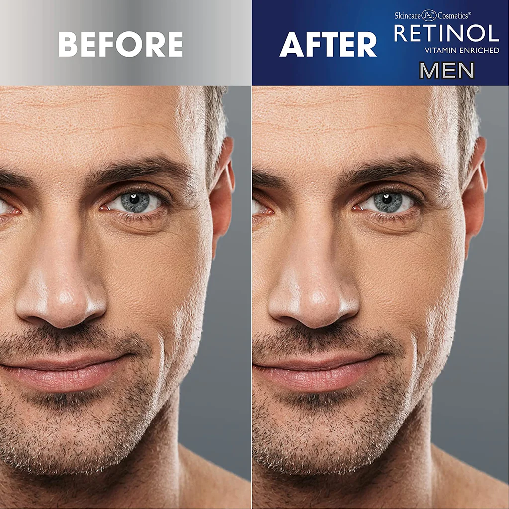 Ret-Men-before-after_b216c57a-9bf2-4a9f-b124-b1a604cd3bff_1024x1024.jpg