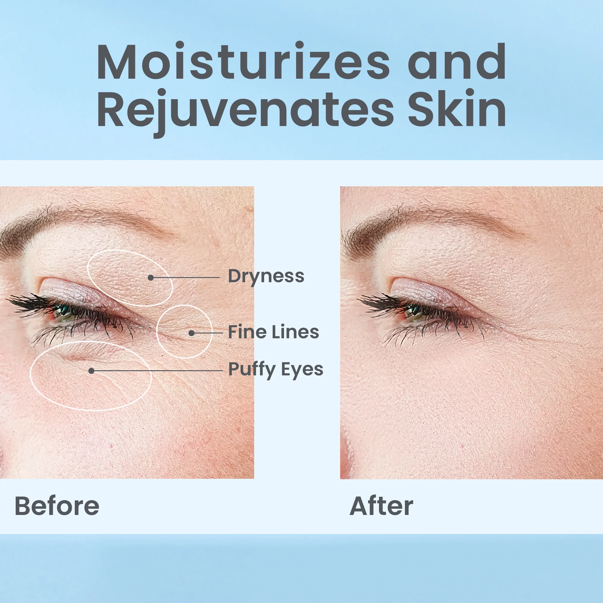 Skinlab_HR_EyeGel_BeforeAfter2.jpg